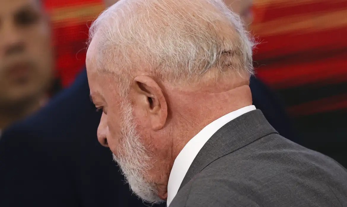 Presidente Lula passa por procedimento para evitar novo sangramento na cabeça