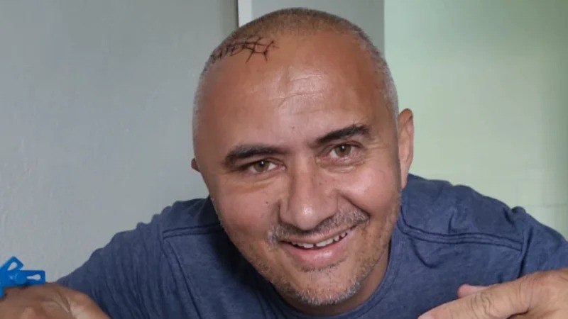 Rio-grandino faz vakinha para compra de remédio para tratar câncer de alto grau