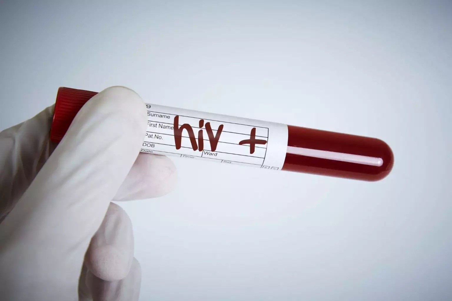 Nova variante do HIV é detectada no RS, Bahia e Rio de Janeiro