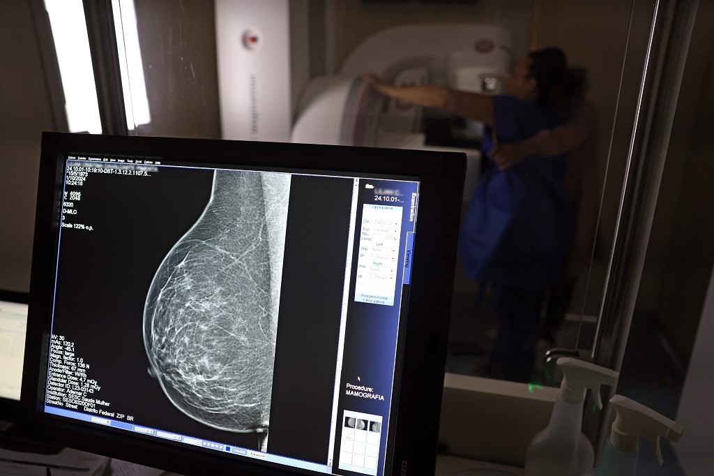 Mortalidade por câncer de mama cai 8,9% no RS em 2024, apesar de Estado possuir terceira maior incidência da doença no país