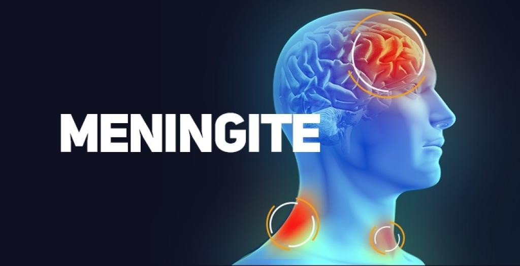Secretaria da Saúde alerta população sobre prevenção à meningite
