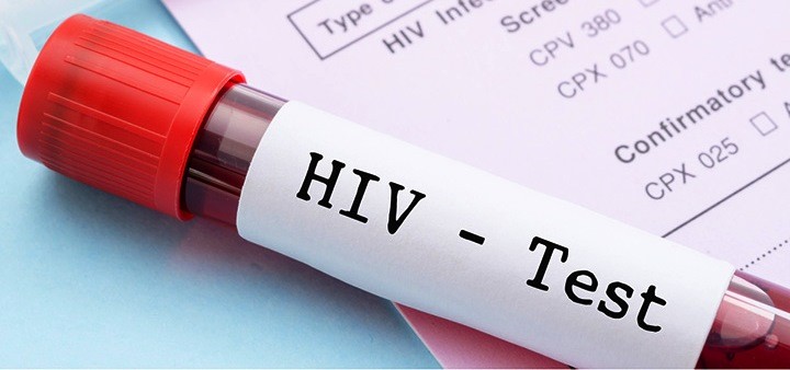 Autoteste para detecção do HIV estará à venda em 2016