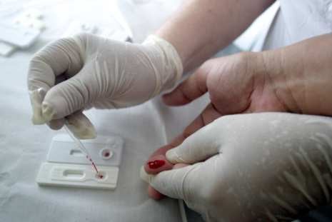 Casos de sífilis voltam a aumentar no Brasil
