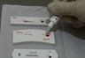 Em Salvador, testes rápidos diagnosticam 15 casos de HIV