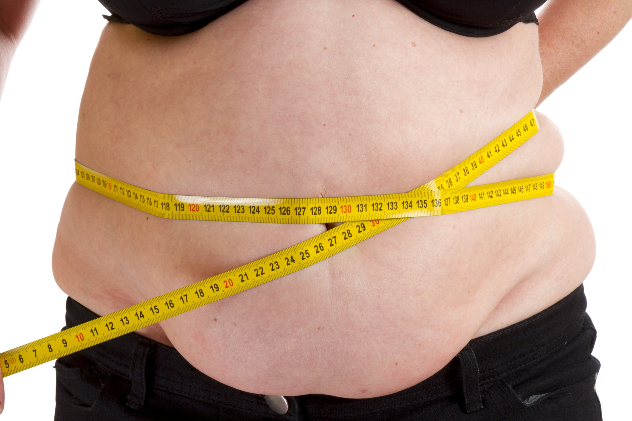 Obesidade abdominal gera risco de AVC em mulheres