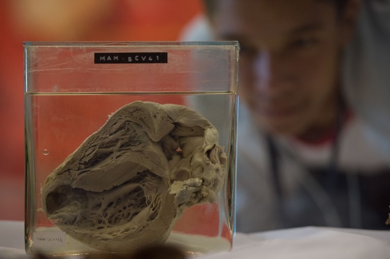 Doenças cardiovasculares são principal causa de morte no mundo