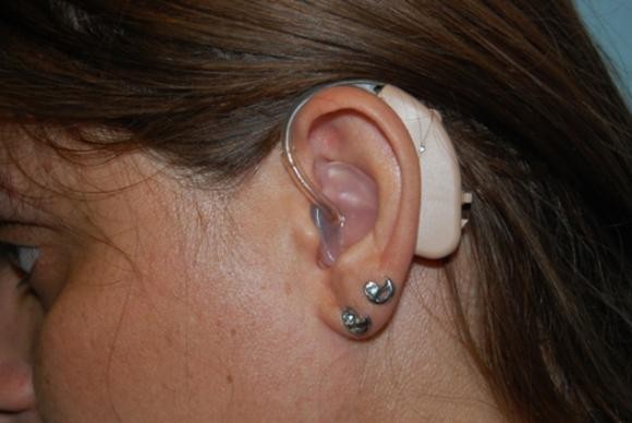 Jovens estão perdendo audição por causa de fones de ouvido