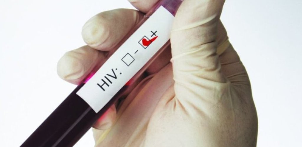 Mortes por Aids caem no RS