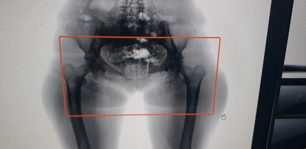 Tentativa de entrada com drogas na Perg termina em prisão de mulher por tráfico