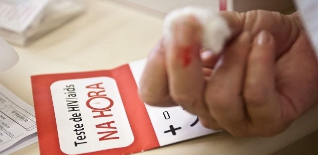 Aids: casos e óbitos caem 16% nos últimos quatro anos no Brasil
