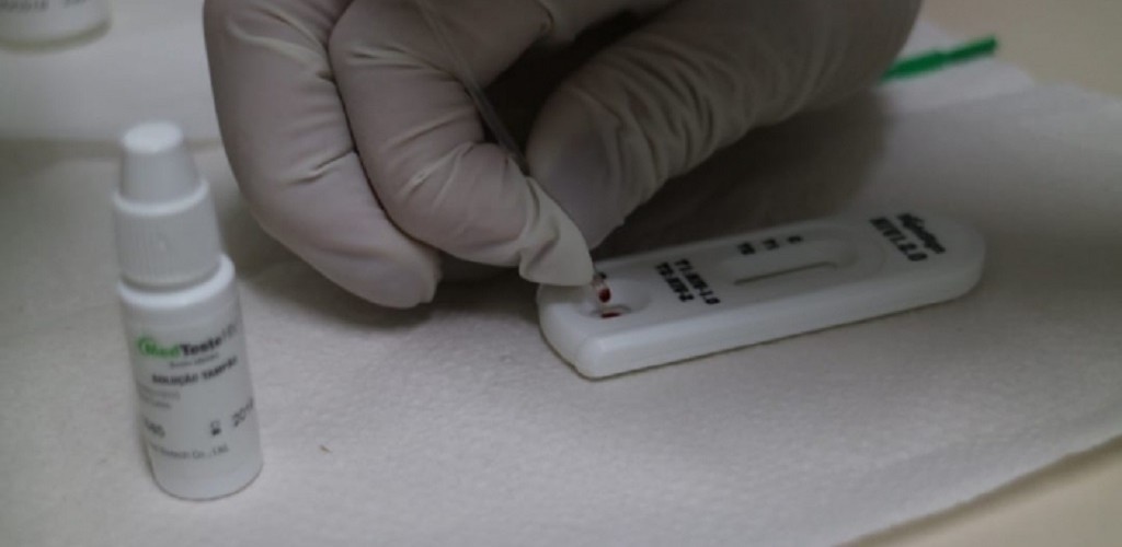 SMS oferece testes rápidos gratuitos de HIV, Sífilis, Hepatites B e C