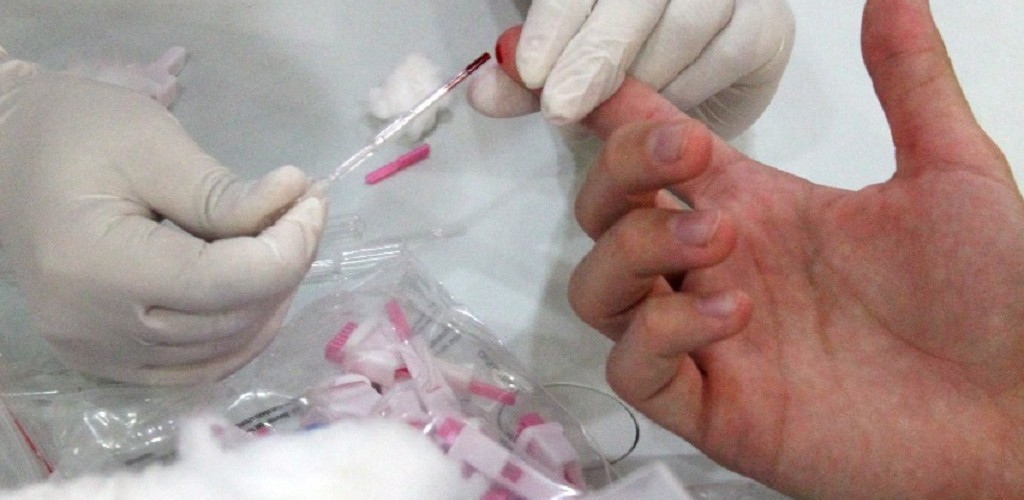 Testagem para HIV, hepatites e sífilis são oferecidas a acadêmicos