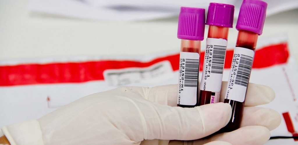 IGP realiza trabalho científico de ponta na segurança pública