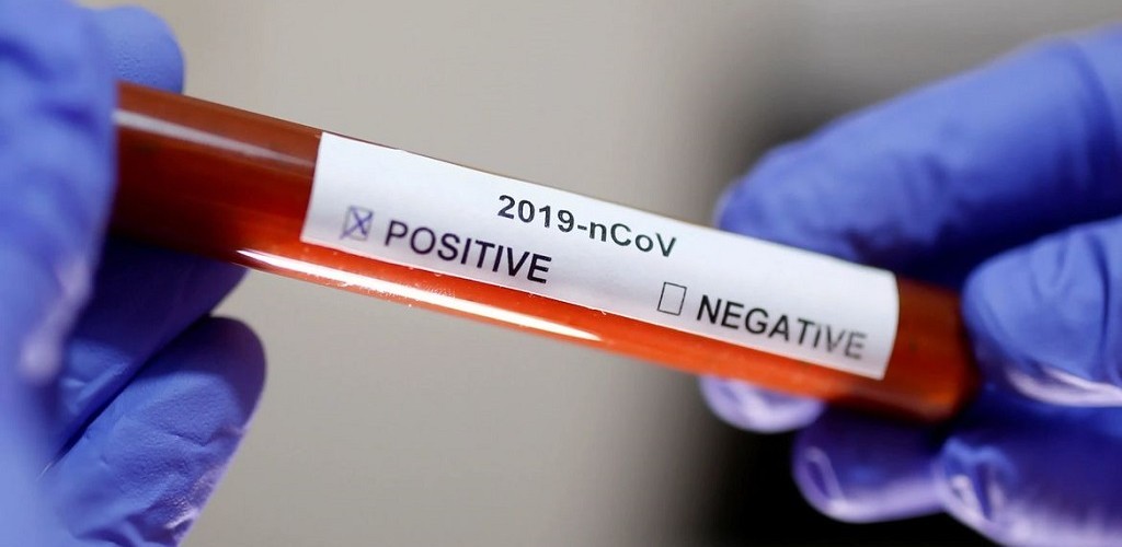 Brasil tem 22,1 mil casos de covid-19; mortes chegam a 1,2 mil