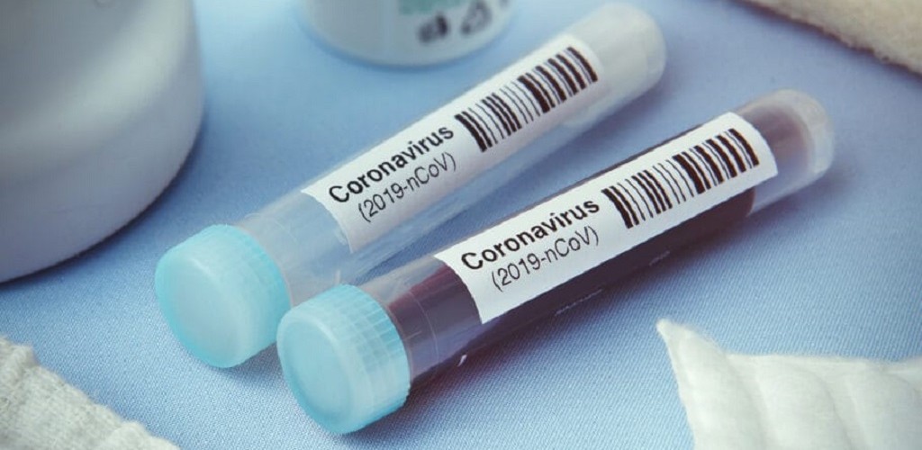 Casos suspeitos de Covid-19 crescem em RG e prefeitura investiga óbito