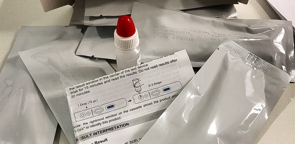 Pelotas realizou cerca de 1,8 mil exames para o novo coronavírus