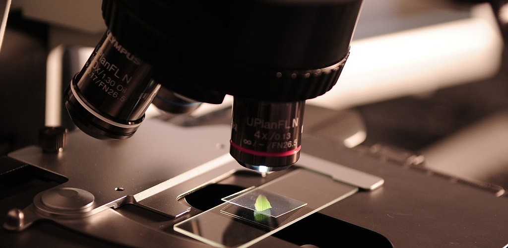 Estudo mostra que tipo sanguíneo e genes podem estar ligados à Covid-19 grave