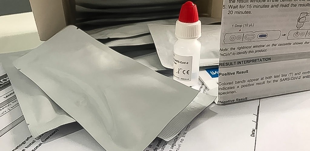 Pelotas alcança os 4.051 testes para detectar casos de Covid-19