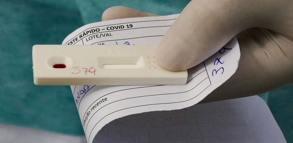 Saiba como fazer o teste diagnóstico de Covid-19 pelo plano de saúde