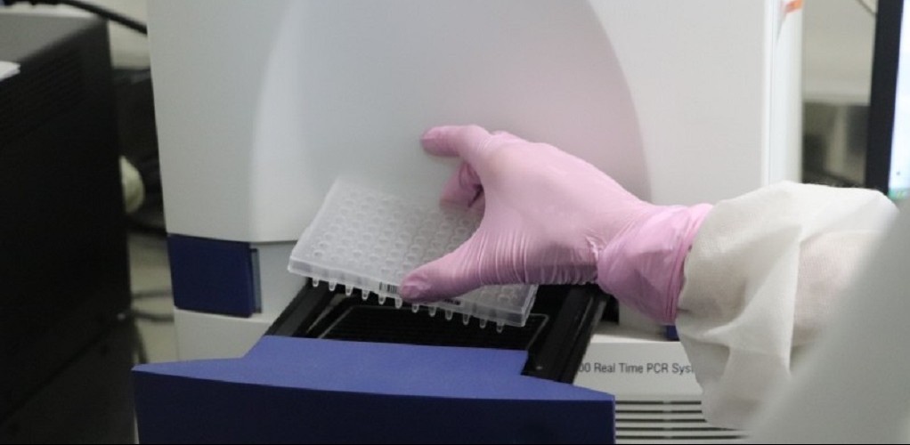 Com o projeto Testar RS, 6,8 mil amostras já foram enviadas para testagem da Covid-19 fora do Estado 