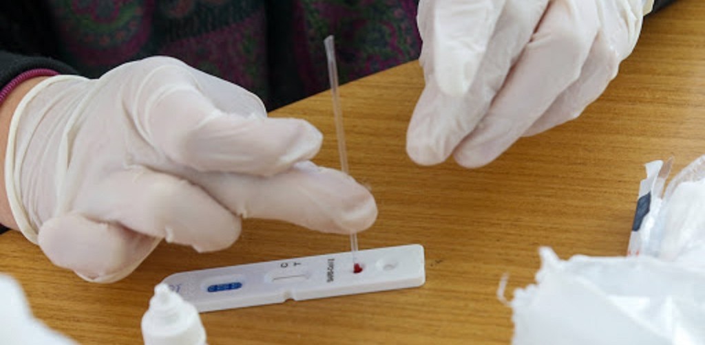 ANS decide que planos de saúde precisam cobrir teste sorológico de Covid-19