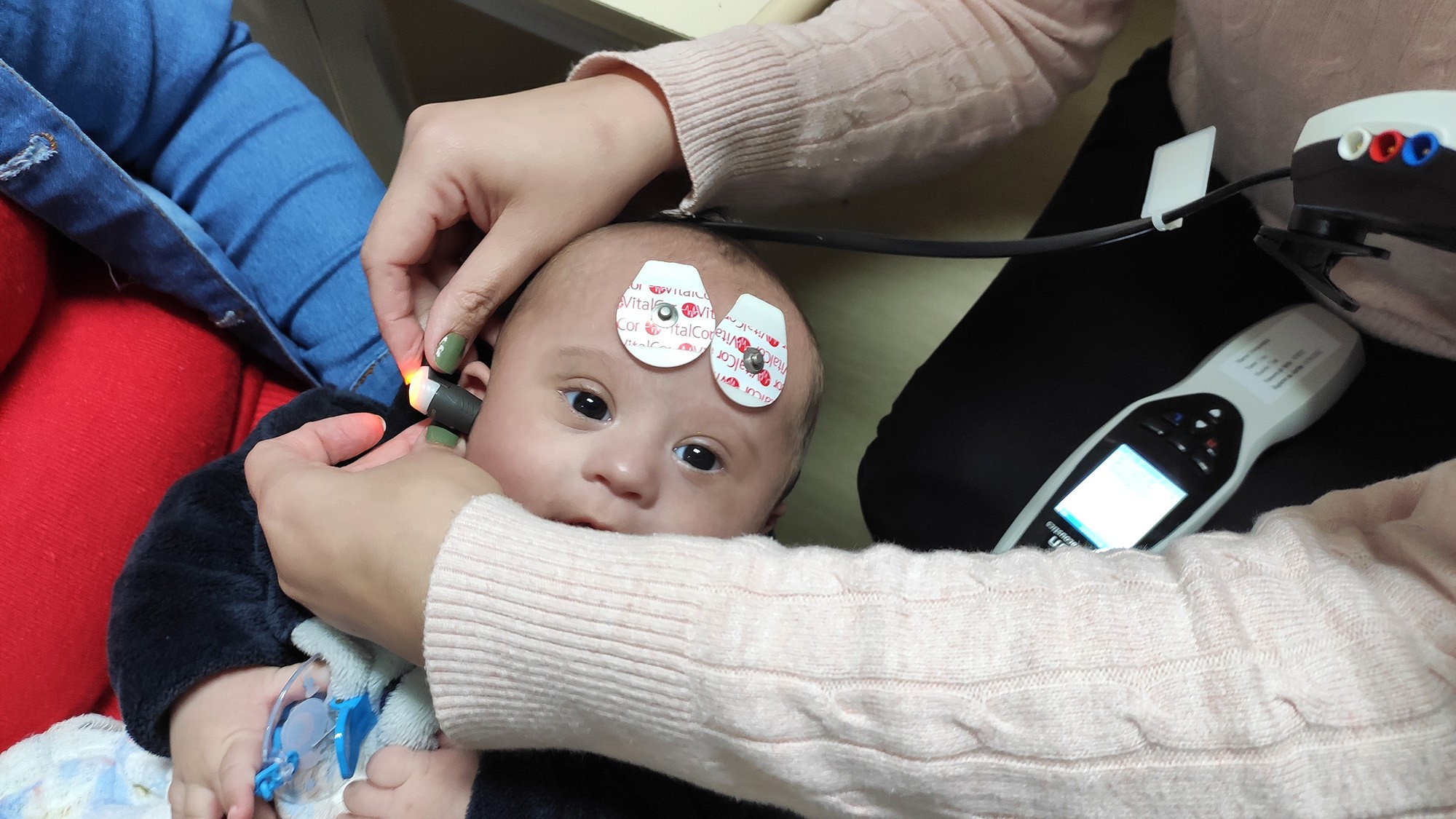 HU-Furg é referência na Triagem Auditiva Neonatal