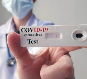 Confira as datas para realizar testes de Covid-19 nas salas extras em Rio Grande