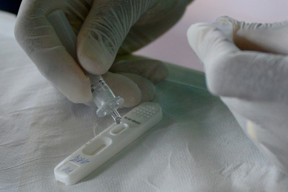 Anvisa recebe primeiro pedido para registro de autoteste de Covid-19