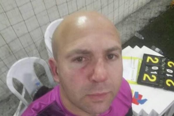 Afastado do futebol por agressão, William Ribeiro se envolve novamente em caso de violência contra arbitragem, em Pelotas