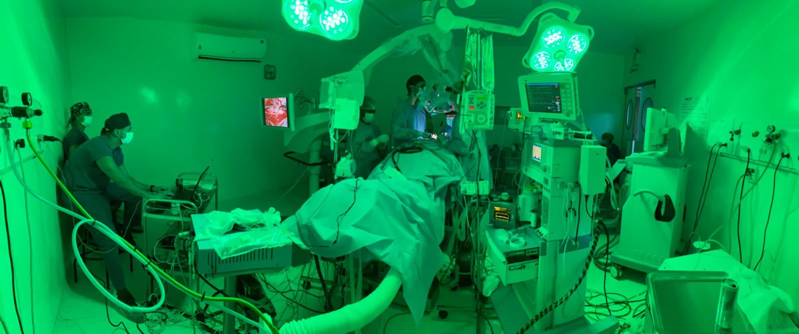 Santa Casa realiza primeira cirurgia com aspirador ultrassônico e monitorização neurofisiológica para retirada de tumor medular