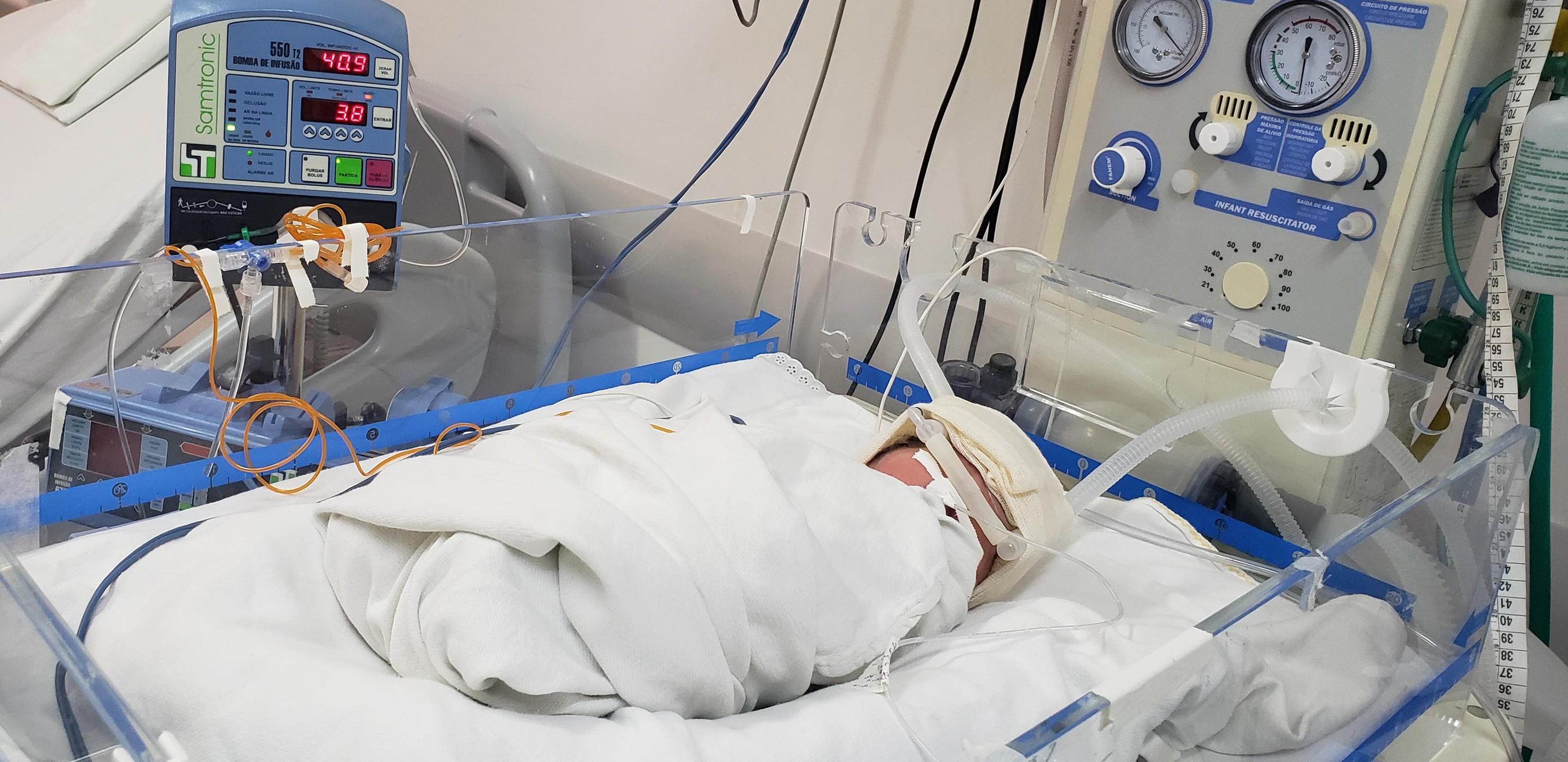 Estado de saúde de bebê de seis meses baleado na cabeça em Rio Grande é considerado grave