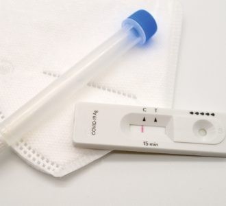 Saúde de Rio Grande adquire mais 20 mil testes rápidos para Covid-19
