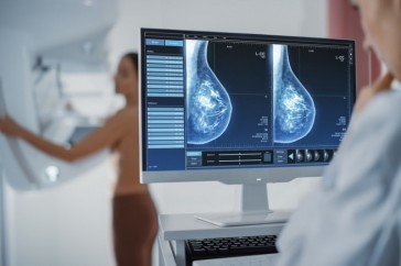 Faltas em exames de mamografia preocupam Secretaria da Saúde de São José do Norte